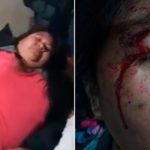 Argentina. La REDH contra el racismo y la violencia institucional policial