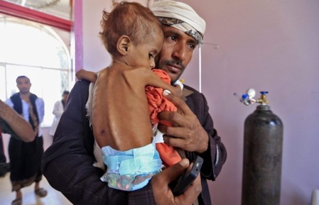 Yemen. Naciones Unidas ignora el gran sufrimiento humano del pueblo yemenita.