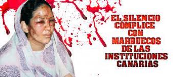 Sáhara Occidental.                 EL GOBIERNO Y EL RESTO DE INSTITUCIONES CANARIAS ESTÁN GUARDANDO SILENCIO ANTE LOS CRÍMENES DE MARRUECOS