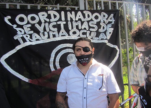 Chile. Víctimas de trauma ocular: El estado nos sigue disparando