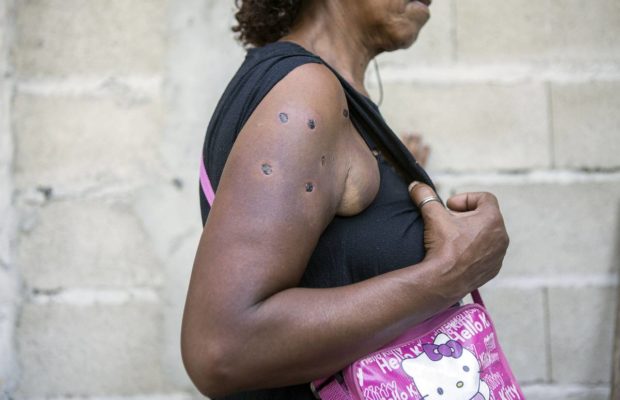 Uruguay. Para esto sirve la LUC: Mujeres heridas por la policía en Malvín Norte denuncian uso abusivo de la fuerza y discriminación