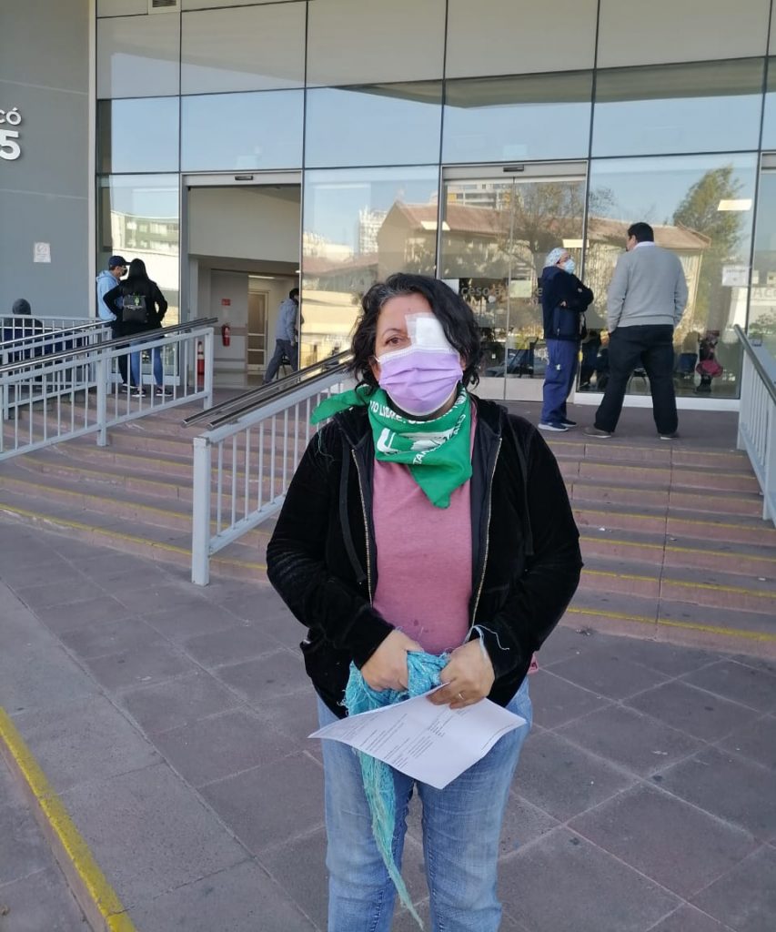 Manifestante denuncia agresi&oacute;n en su ojo por efectivos policiales afuera del ex Congreso